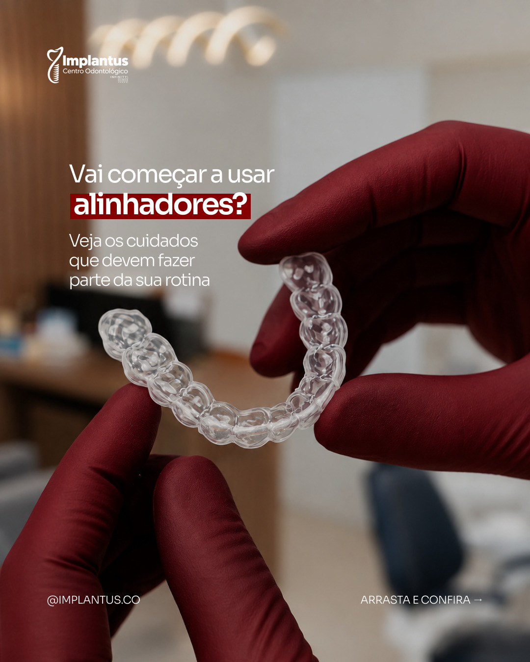 Alinhadores Invisíveis na Implantus